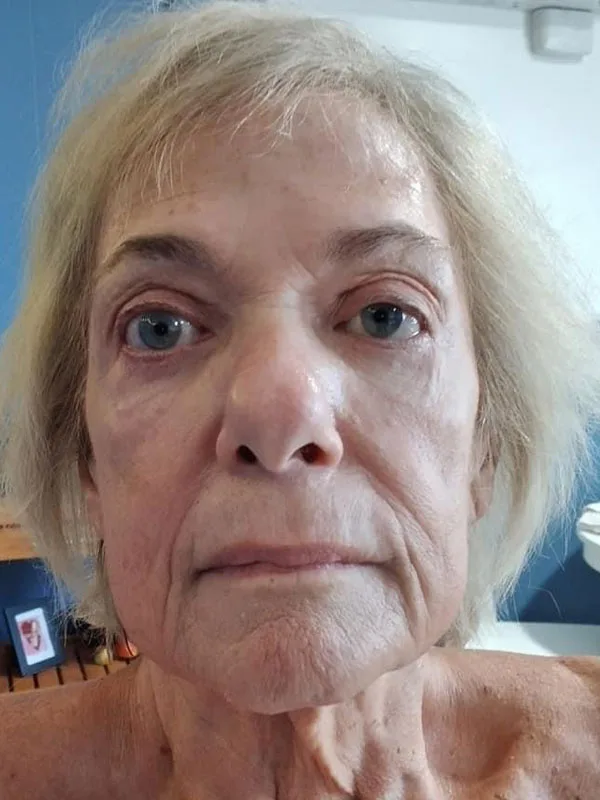 Lymphatic Facial Rejuvenation MLD 3 - Image 6