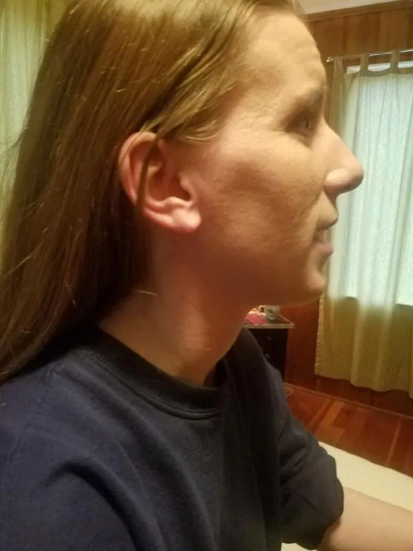 Lymphatic Facial Rejuvenation MLD 3 - Image 4