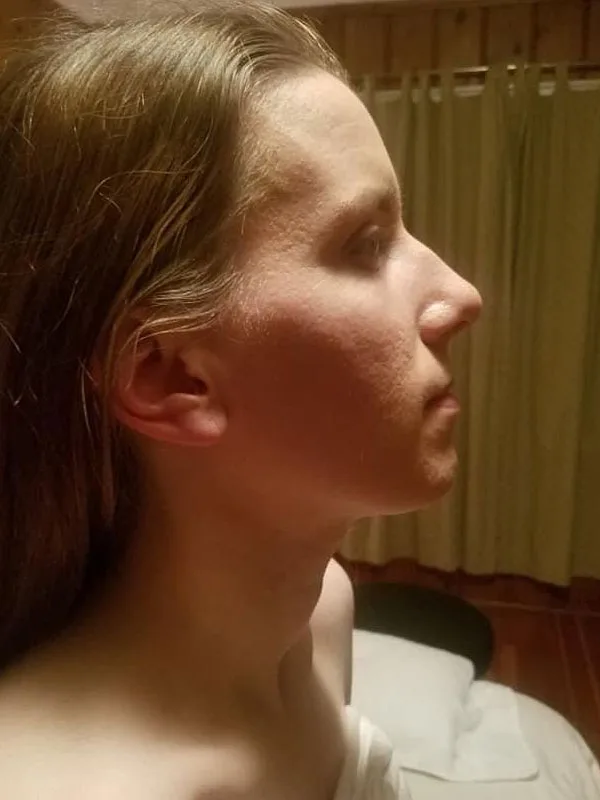 Lymphatic Facial Rejuvenation MLD 3 - Image 5