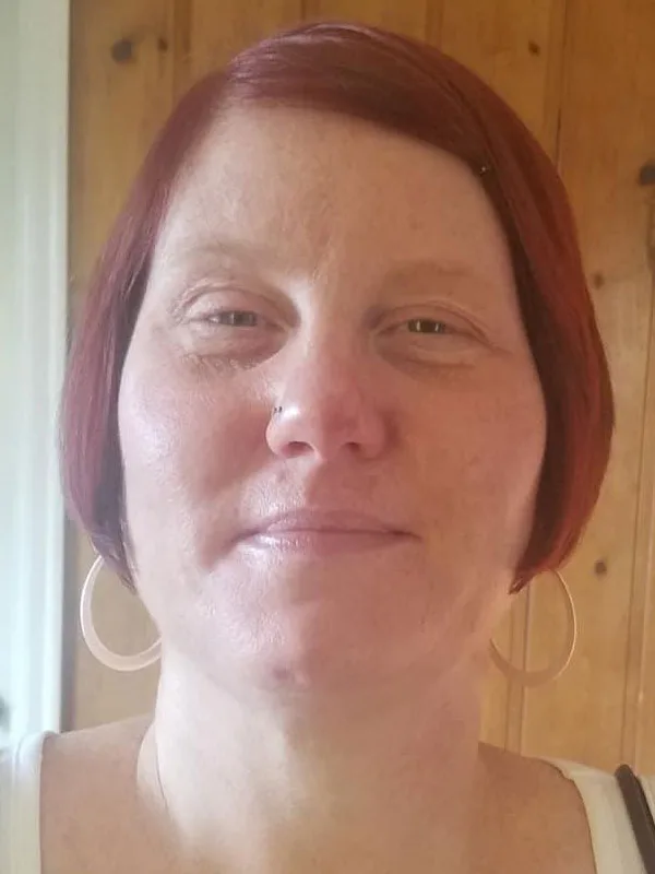 Lymphatic Facial Rejuvenation MLD 3 - Image 2