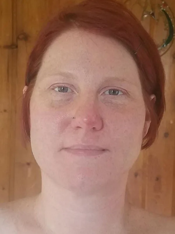 Lymphatic Facial Rejuvenation MLD 3 - Image 3